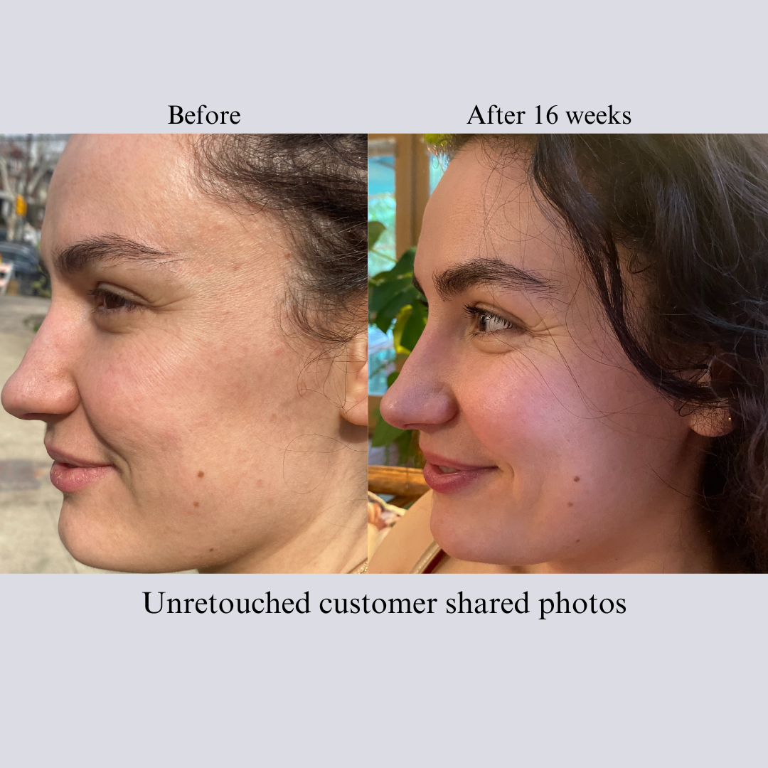 Hyaluron 3D Hydrator Multi Lamellar Emulsion The Advanced Response Face and Neck Cream-Serum